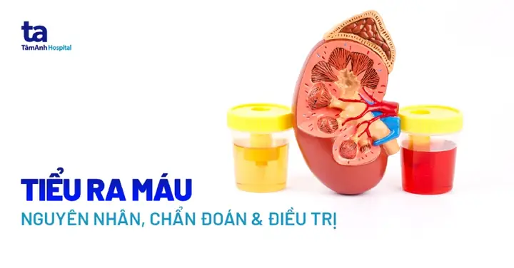 Cách Làm Nước Màu Đường Chuẩn Nhà Hàng Dễ Thành Công Cách Làm Nước Màu Đường Chuẩn Nhà Hàng Dễ Thành Công